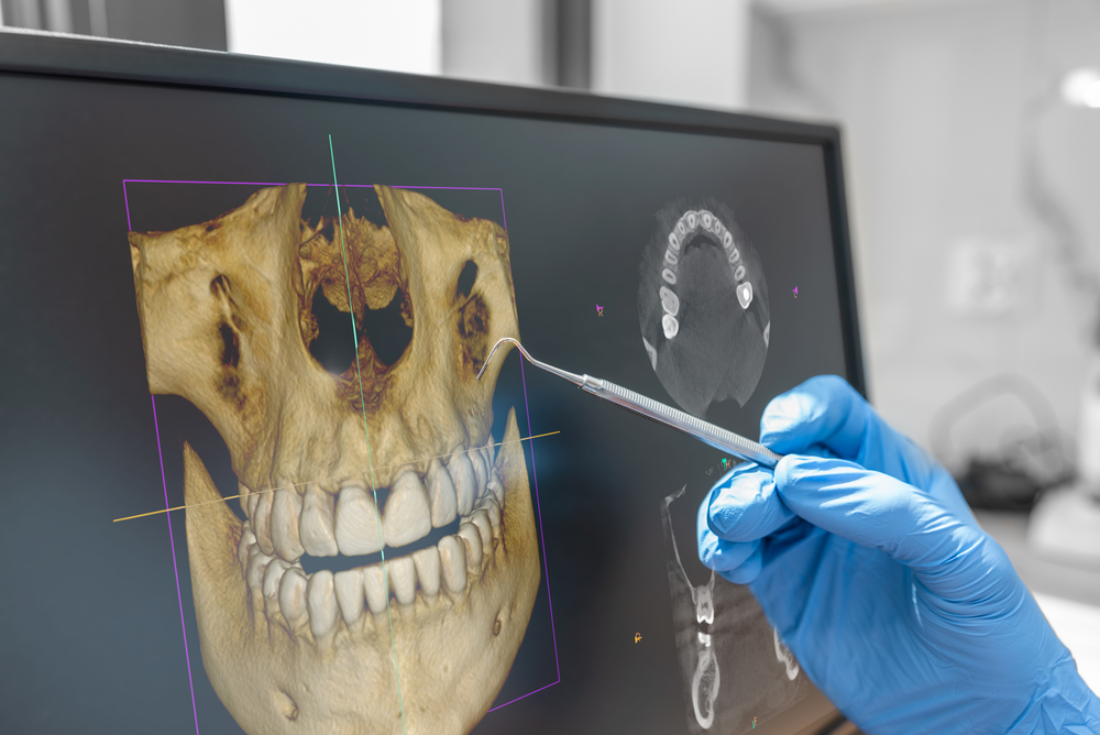Dental XRays Blog